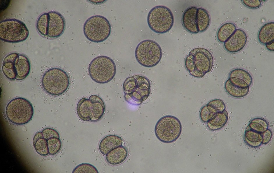 Улучшить здоровье поможет добавление в рацион клетчатки